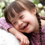 Anomalías de oído en niños con Síndrome de Down